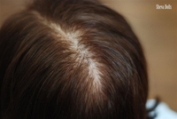 micro-rooted human hair